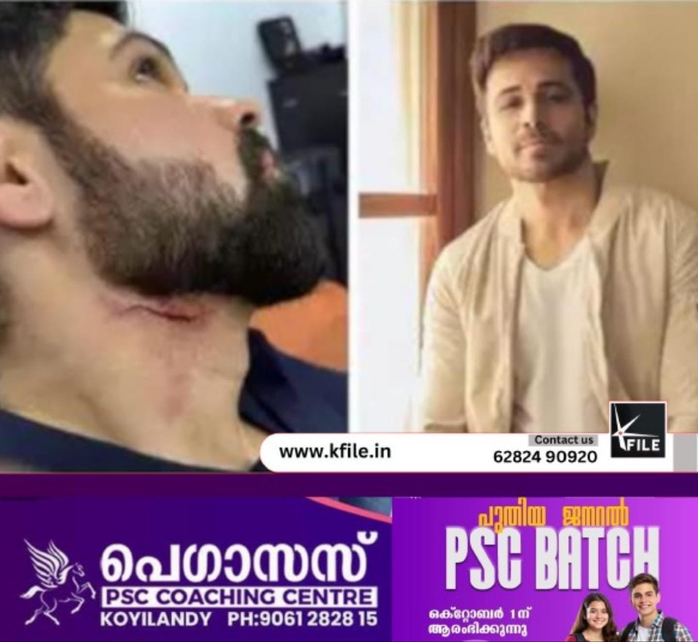 ബോളിവുഡ് താരം ഇമ്രാൻ ഹാഷ്മിക് പരിക്ക് ബോളിവുഡ് താരം ഇമ്രാൻ ഹാഷ്മിക് പരിക്ക്