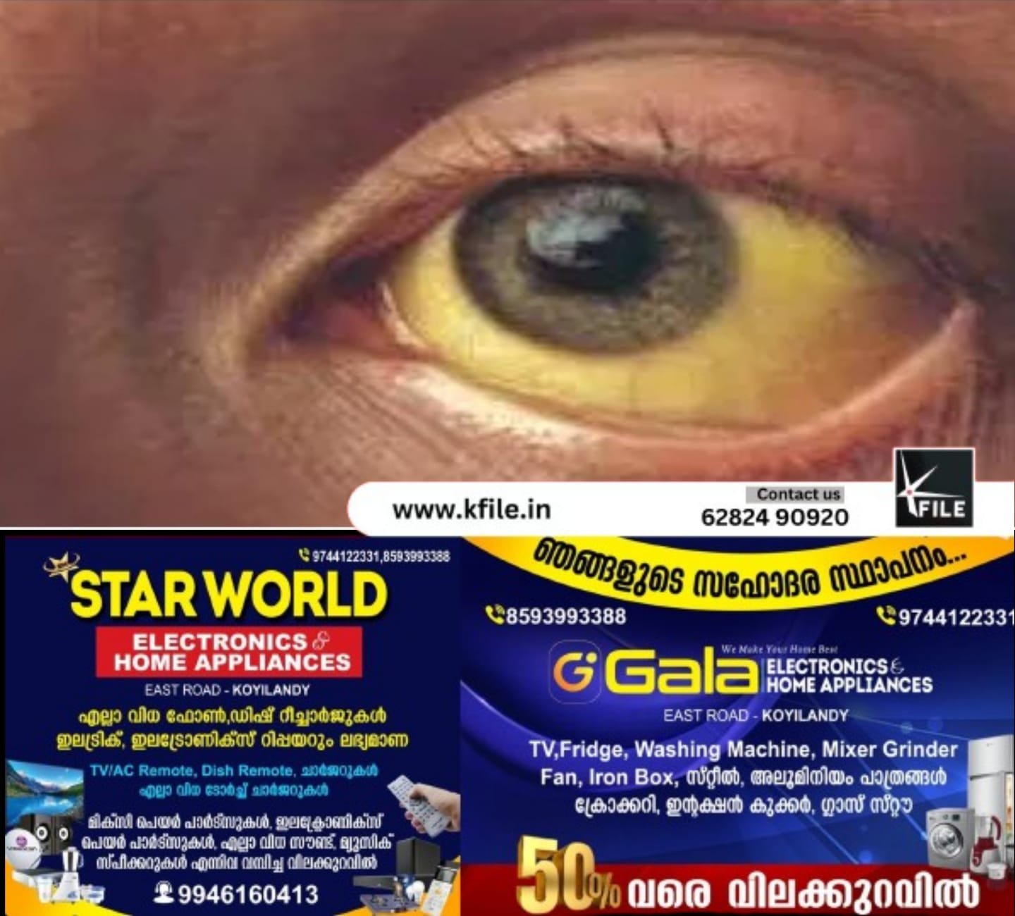 കോഴിക്കോട് ജില്ലയിൽ മഞ്ഞപ്പിത്തത്തിനൊപ്പം എലിപ്പനിയും, ഡെങ്കിപ്പനിയും പടരുന്നു കോഴിക്കോട് ജില്ലയിൽ മഞ്ഞപ്പിത്തത്തിനൊപ്പം എലിപ്പനിയും, ഡെങ്കിപ്പനിയും പടരുന്നു