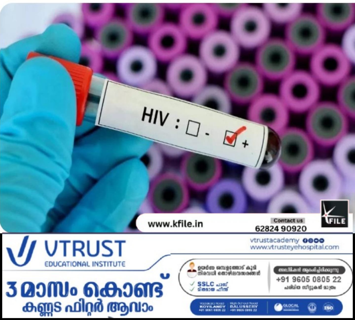 പെരുമ്പാവൂരിൽ എച്ച്.ഐ.വി രോഗബാധിതർ വർധിക്കുന്നു- ആരോഗ്യവകുപ്പ്
