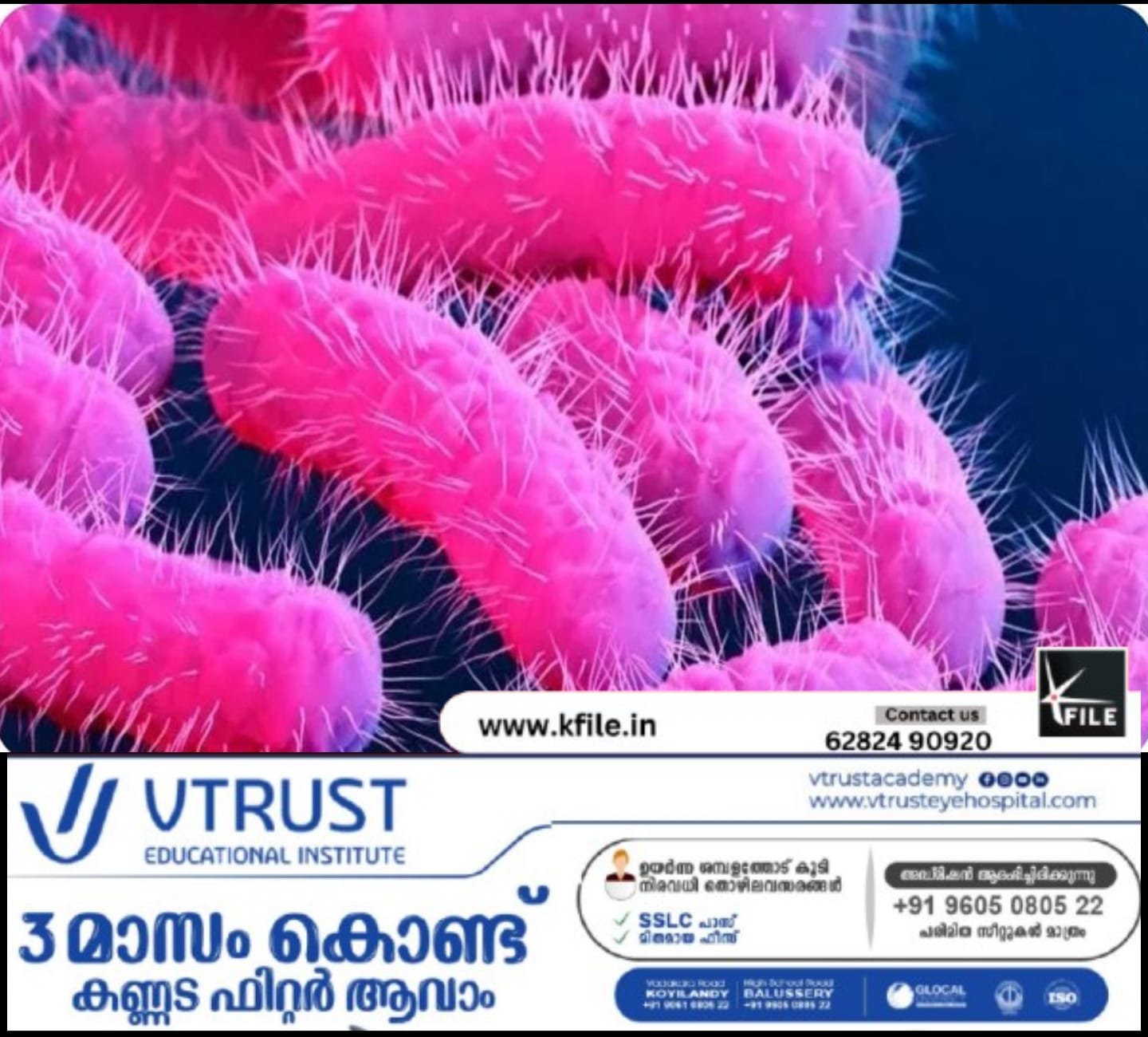 കോഴിക്കോട് മൂന്നര വയസുകാരി ഷിഗല്ല ബാധിച്ച് മരിച്ചു