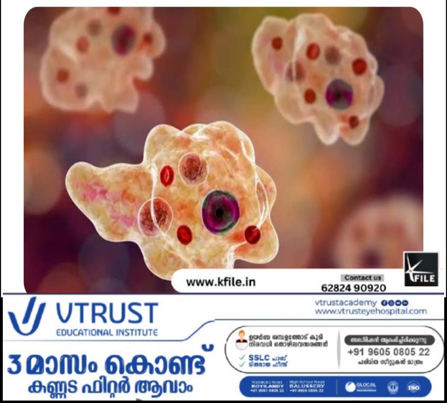 വേനൽ കടുക്കുന്നു, ഒപ്പം അമീബ ഭീഷണിയും