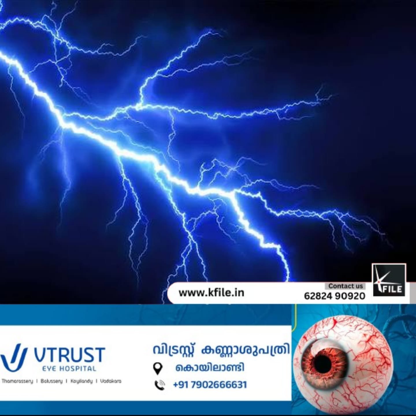 കളിച്ചുകൊണ്ടിരുന്ന നാല് കുട്ടികൾക്ക് ഇടിമിന്നലേറ്റു