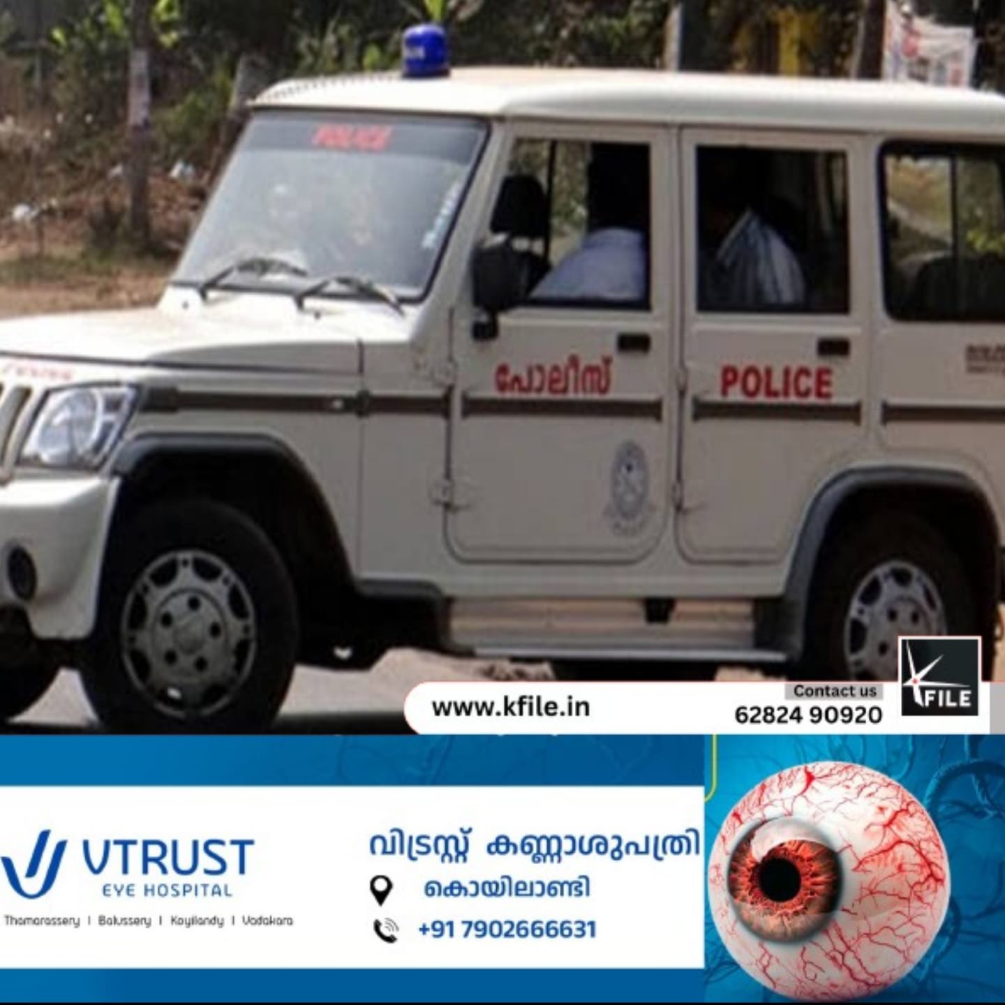മരുമകളുടെ മാലപൊട്ടിക്കുന്നത് തടയാൻ ശ്രമിക്കുന്നതിനിടെ കൊച്ചി സ്വദേശിയുടെ തള്ളവിരൽ മോഷ്‌ടാവ് കടിച്ചുമുറിച്ചു