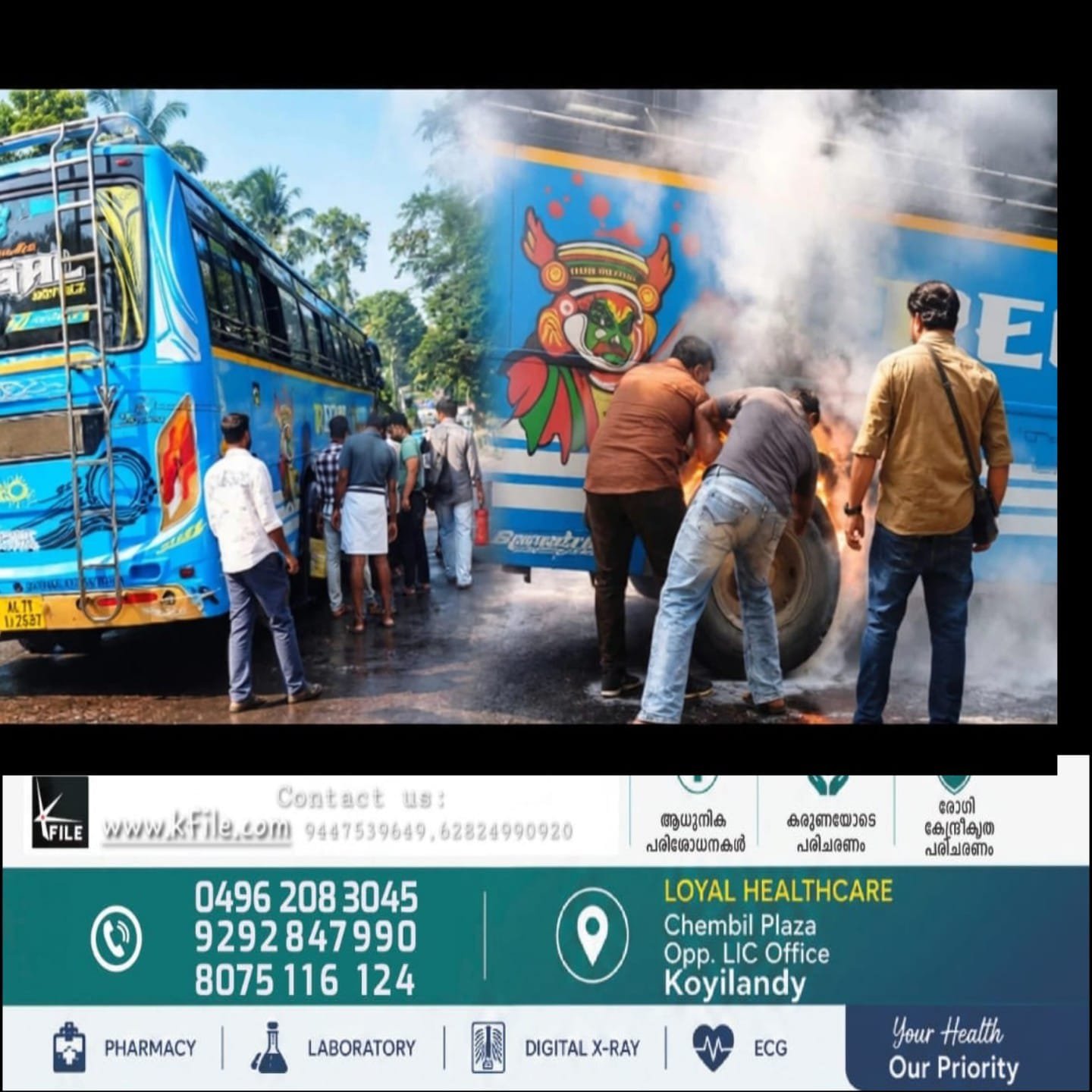 നാദാപുരത്ത് ഓടിക്കൊണ്ടിരുന്ന സ്വകാര്യ ബസിന്റെ ടയർ പൊട്ടിത്തെറിച്ച് തീപിടിത്തം; വൻ ദുരന്തം ഒഴിവായി നാദാപുരത്ത് ഓടിക്കൊണ്ടിരുന്ന സ്വകാര്യ ബസിന്റെ ടയർ പൊട്ടിത്തെറിച്ച് തീപിടിത്തം; വൻ ദുരന്തം ഒഴിവായി